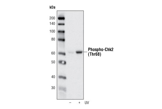Phospho-Chk2 (Thr68) (C13C1) Rabbit mAb