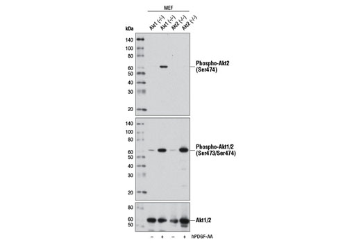 Phospho-Akt2 (Ser474) (D3H2) Rabbit mAb (Akt2 Specific)