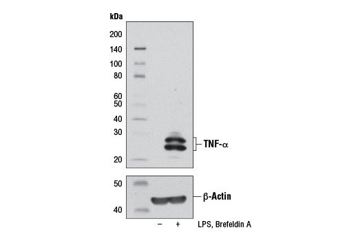 TNF-α (D2D4) XP Rabbit mAb (Mouse Specific)