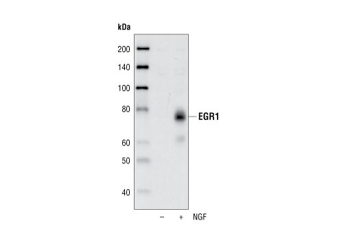 EGR1 (44D5) Rabbit mAb