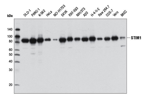 STIM1 (D88E10) Rabbit mAb