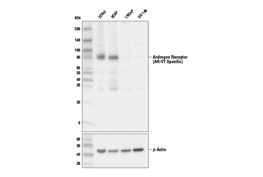 Androgen Receptor (AR-V7 Specific) (E3O8L) Rabbit mAb