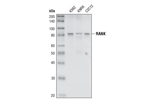 RANK Antibody