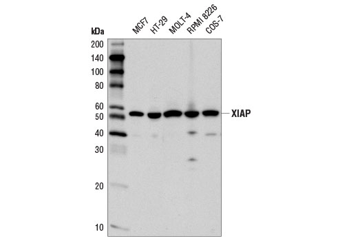 XIAP (D2Z8W) Rabbit mAb