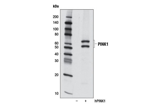 PINK1 (D8G3) Rabbit mAb