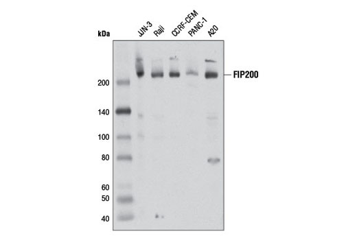 Autophagy Induction (ULK1 Complex) Antibody Sampler Kit