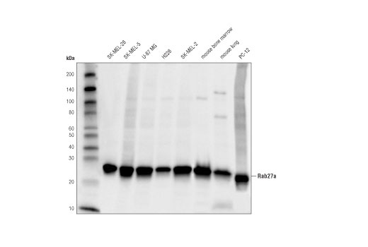 Rab27A (D7Z9Q) Rabbit mAb