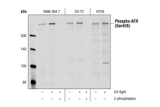 Phospho-ATR (Ser428) Antibody