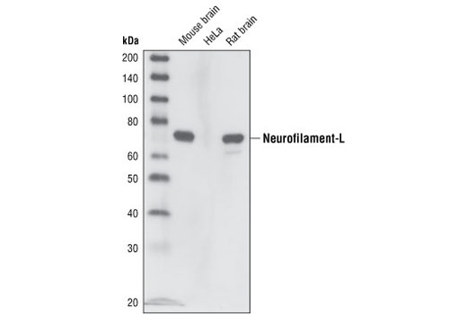 Neurofilament-L (C28E10) Rabbit mAb