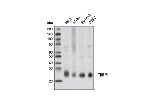 TIMP1 (D10E6) Rabbit mAb