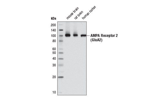 AMPA Receptor 2 (GluA2) (E1L8U) Rabbit mAb
