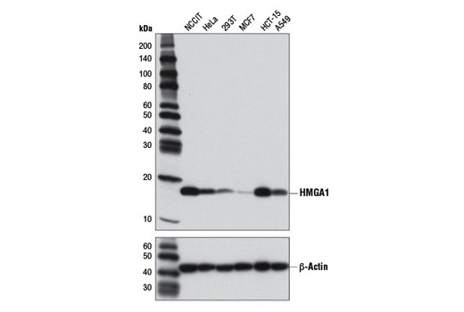 HMGA1 (D6A4) XP Rabbit mAb