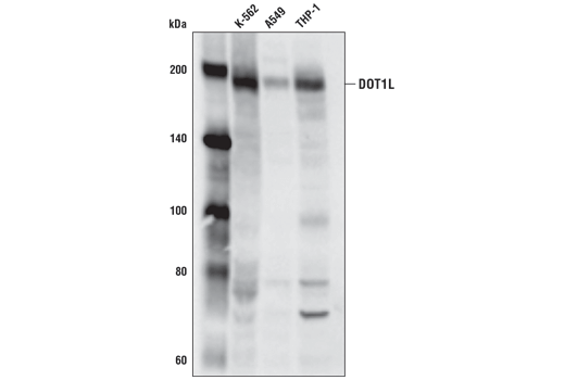 DOT1L (D1W4Z) Rabbit mAb