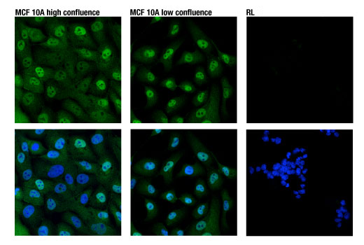 YAP (D8H1X) XP Rabbit mAb (Alexa Fluor 488 Conjugate)