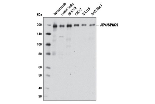 JIP4/SPAG9 (D72F4) XP Rabbit mAb