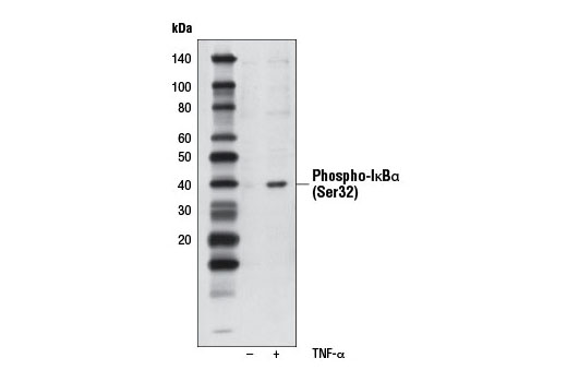 Phospho-IκBα (Ser32) (14D4) Rabbit mAb (Biotinylated)