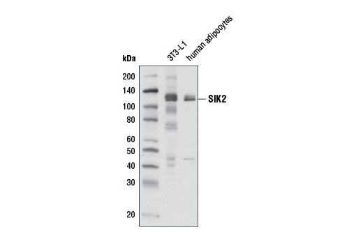 SIK2 (D28G3) Rabbit mAb