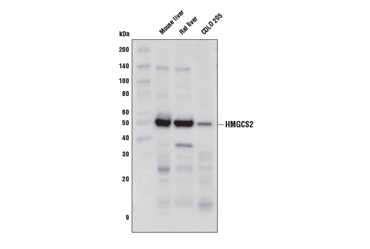 HMGCS2 (D3U1A) Rabbit mAb