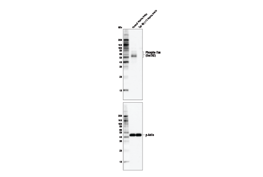 Phospho-Tau (Ser202) (D4H7E) Rabbit mAb