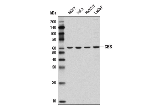 One-Carbon Metabolism Antibody Sampler Kit