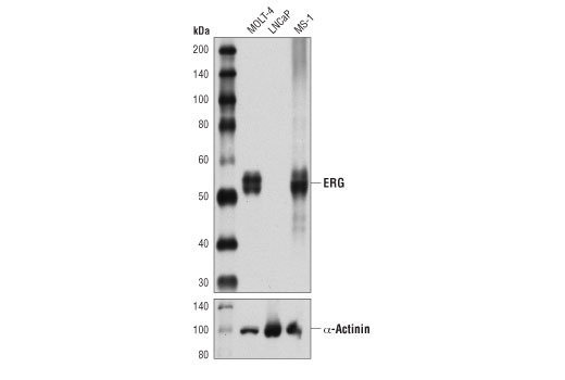 ERG (A7L1G) Rabbit mAb