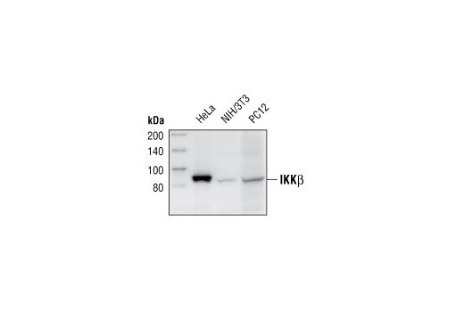 IKKβ (2C8) Rabbit mAb