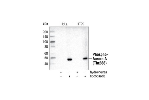 Phospho-Aurora A (Thr288) (C39D8) Rabbit mAb