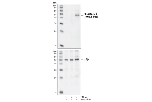 Phospho-IκBβ (Thr19/Ser23) Antibody (Human Specific)