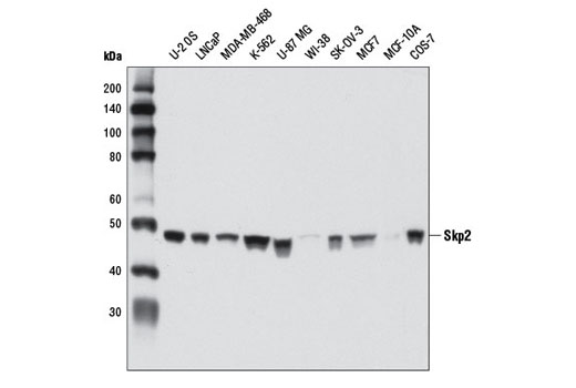 Skp2 (D3G5) XP Rabbit mAb