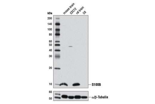 S100B (D10G6) Rabbit mAb