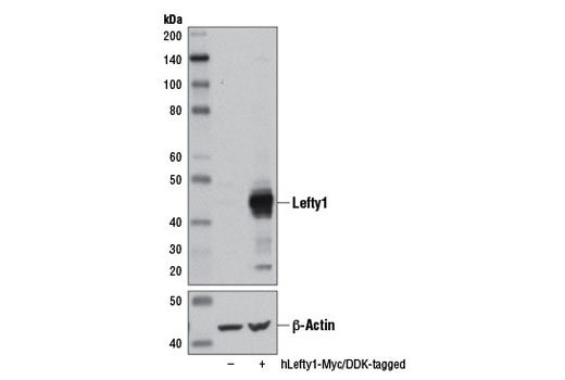 Lefty1 (D7E3G) Rabbit mAb
