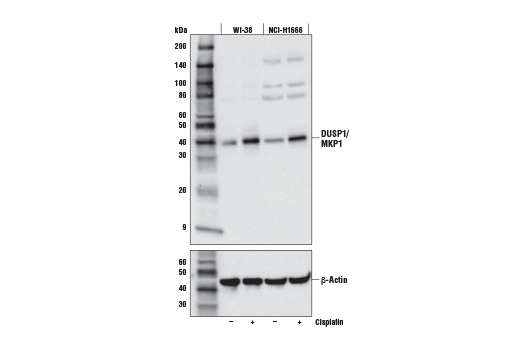 DUSP1/MKP1 (E8L7D) Rabbit mAb