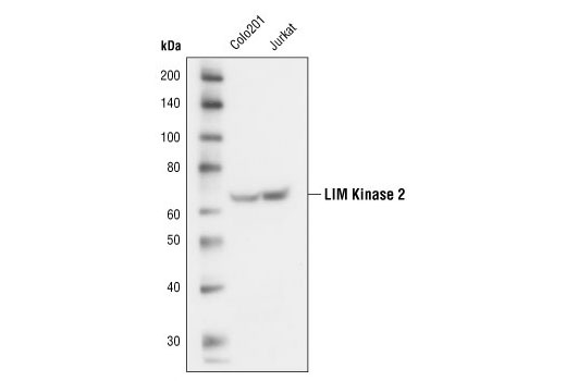 LIMK2 (8C11) Rabbit mAb