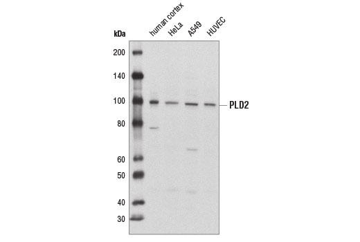 PLD2 (E1Y9G) Rabbit mAb
