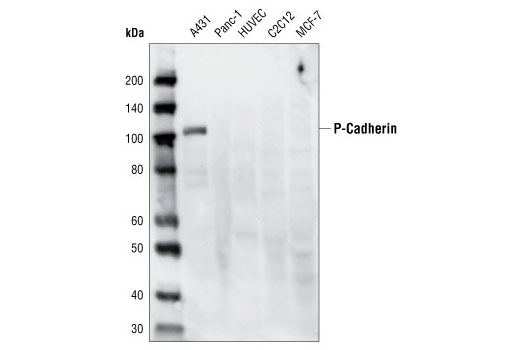 P-Cadherin (C13F9) Rabbit mAb