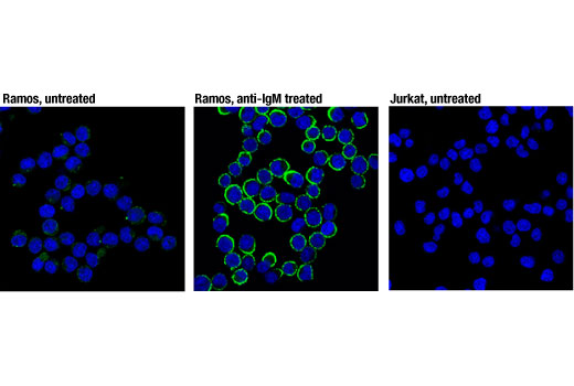 Phospho-CD79A (Tyr182) (D1B9) Rabbit mAb