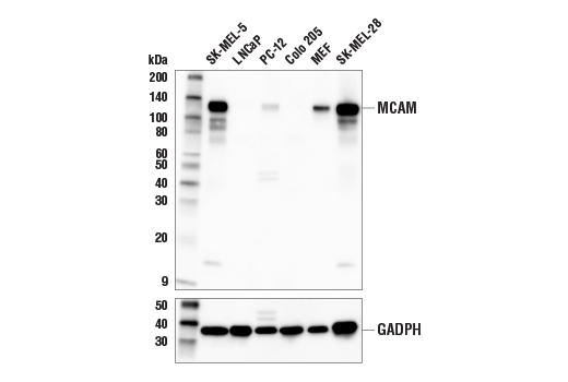 MCAM (E3F3E) XP<lt/>sup&amp;gt; <lt/>/sup&amp;gt;Rabbit mAb