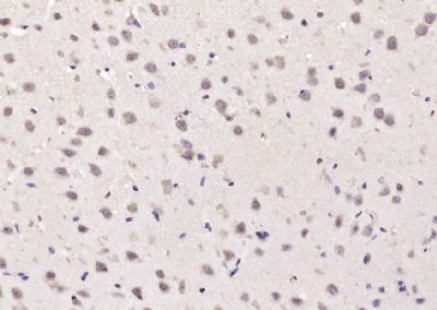 a微管蛋白乙酰转移酶1抗体