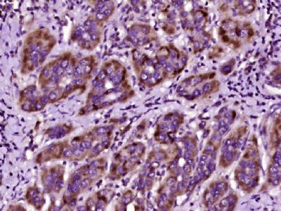 异常凝血酶原/脱-r-羧基凝血酶原抗体