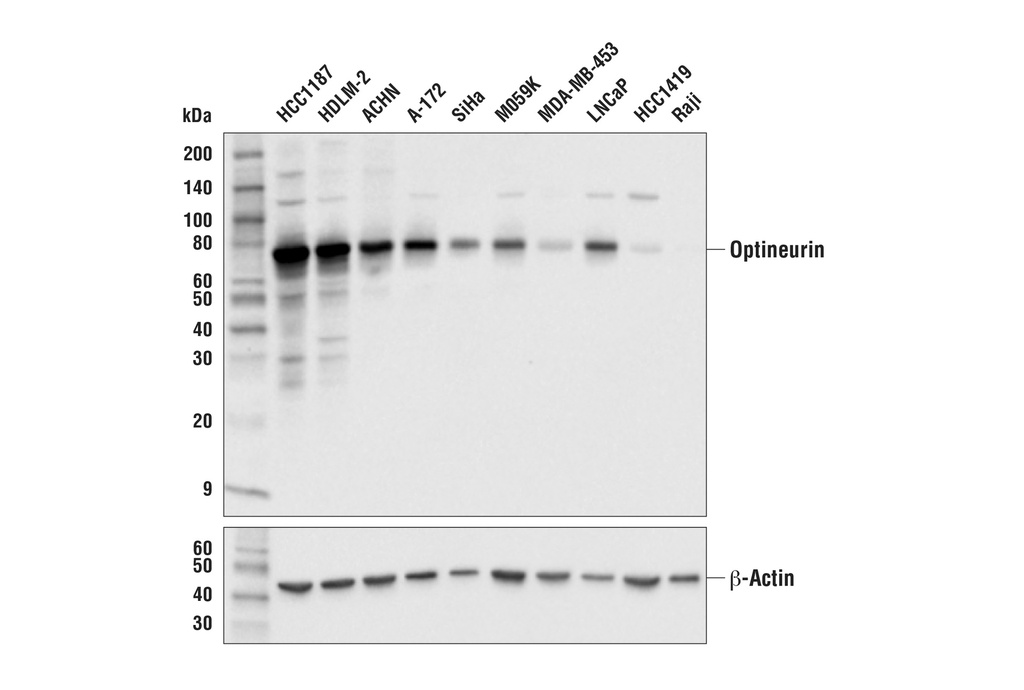 Optineurin (E4P8C) Rabbit mAb