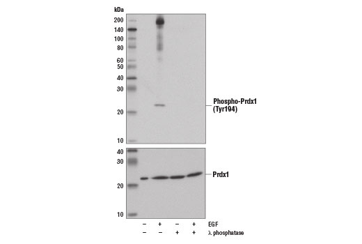 Redox Homeostasis and Signaling Antibody Sampler Kit