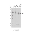 Phospho-Jak Family Antibody Sampler Kit