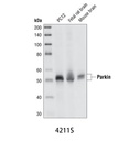 Parkin (Prk8) Mouse mAb