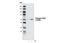 Phospho-Chk2 (Thr68) Antibody