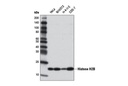 Histone H2B (V119) Antibody