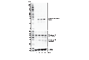Human Reactive Cell Death and Autophagy Antibody Sampler Kit