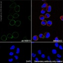 Anti-CD163 antibody [EPR19518]